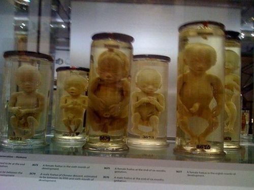 The Hunterian Museum